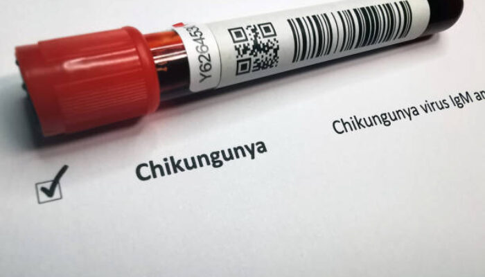 Kasus Suspek Chikungunya 2025 Melonjak, Kemenkes Waspada